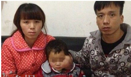 4岁女童患眼癌 4岁女童患眼癌