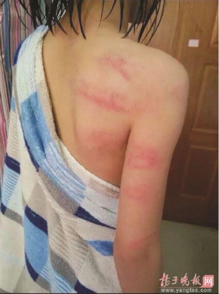 3年级女生没写作文被老师用塑料管抽打 3年级女生没写作文被老师用塑料管抽打